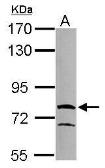 Anti-RUFY1 antibody [N3C3] used in Western Blot (WB). GTX119223